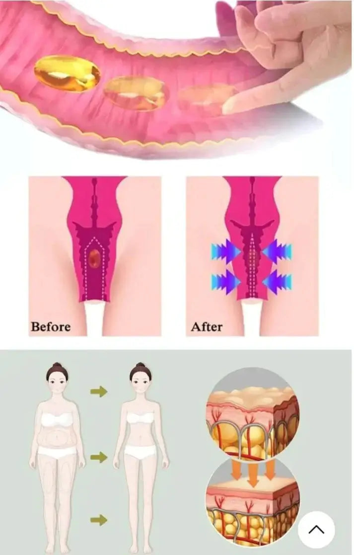 Gélules BioNaturelles de réparation vaginale (01 acheté = 01 offert)