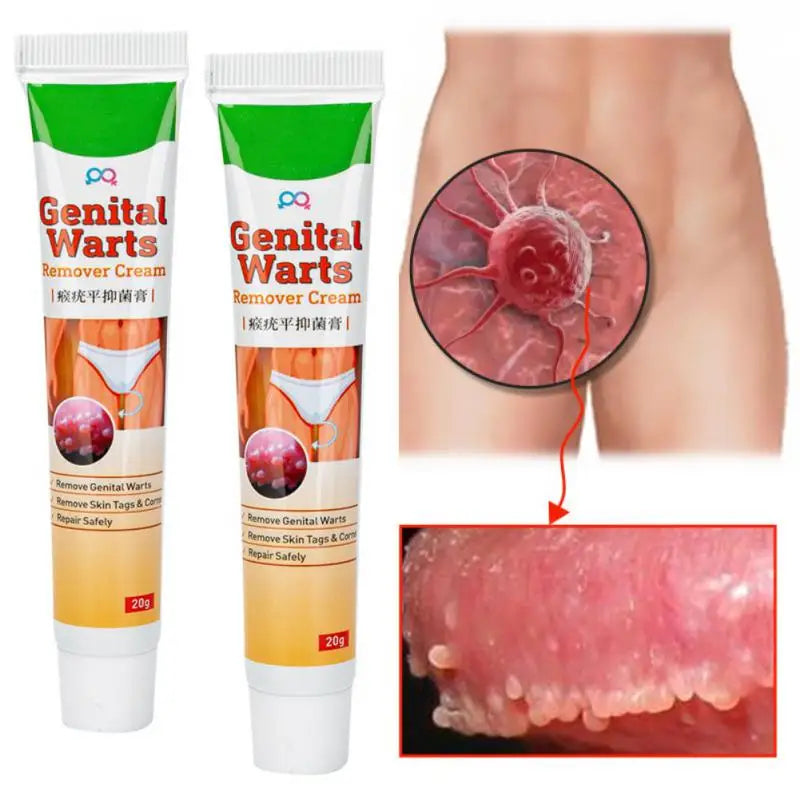 DERMALIS INTIME™ Crème topique pour enlever les condylomes en toute discrétion
