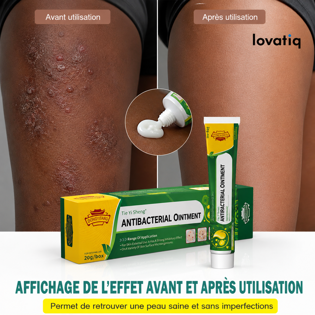 Antibactérien - Retrouve une peau saine naturellement