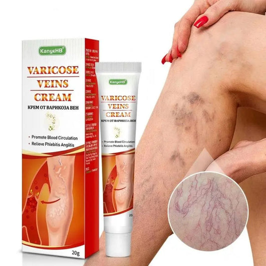 VENALIS™ Crème topique anti-varices & jambes lourdes